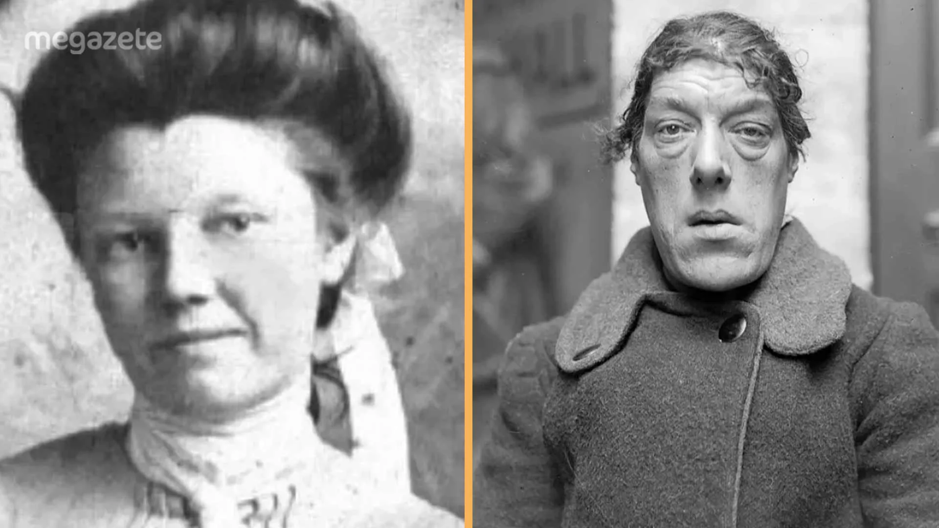 Mary Ann Webster Hastalığı